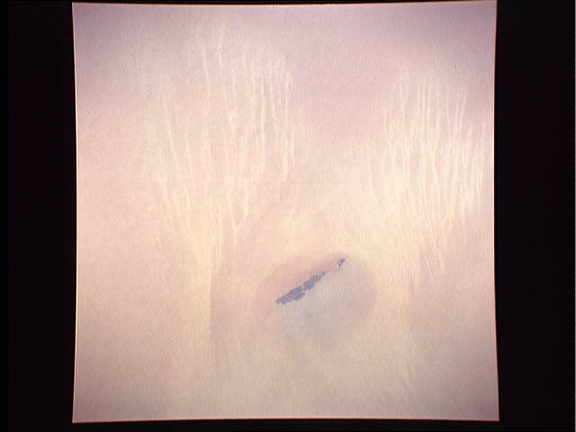 Image display