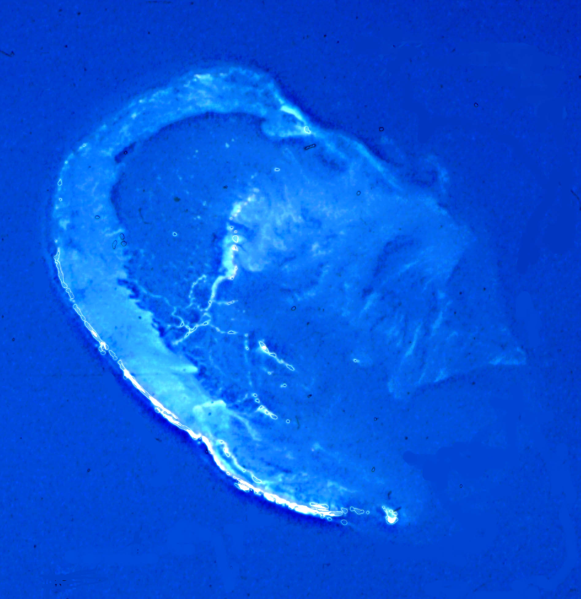 Image display